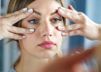 10 Natural Remedies To Reduce Dark Circles