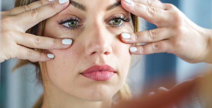 10 Natural Remedies To Reduce Dark Circles