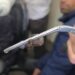 Doctors Remove Snake-Like Worm From Nostril Of An Adolescent Boy In Anantnag